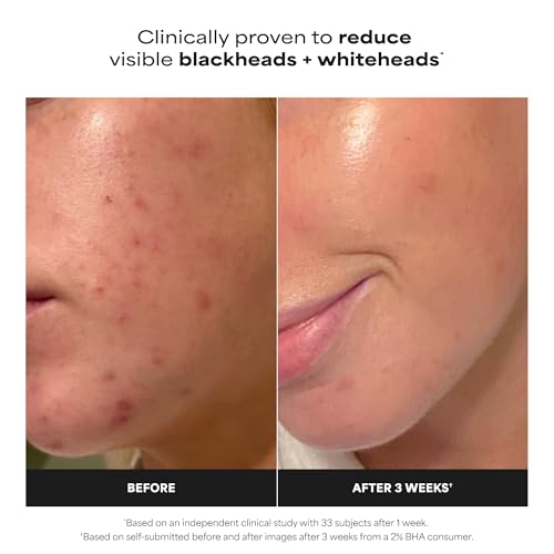 Paula's Choice SKIN PERFECTING 2% BHA Liquid Exfoliant | Gentle Salicylic Acid Facial Exfoliator for Blackheads, Enlarged Pores, Wrinkles & Fine Lines