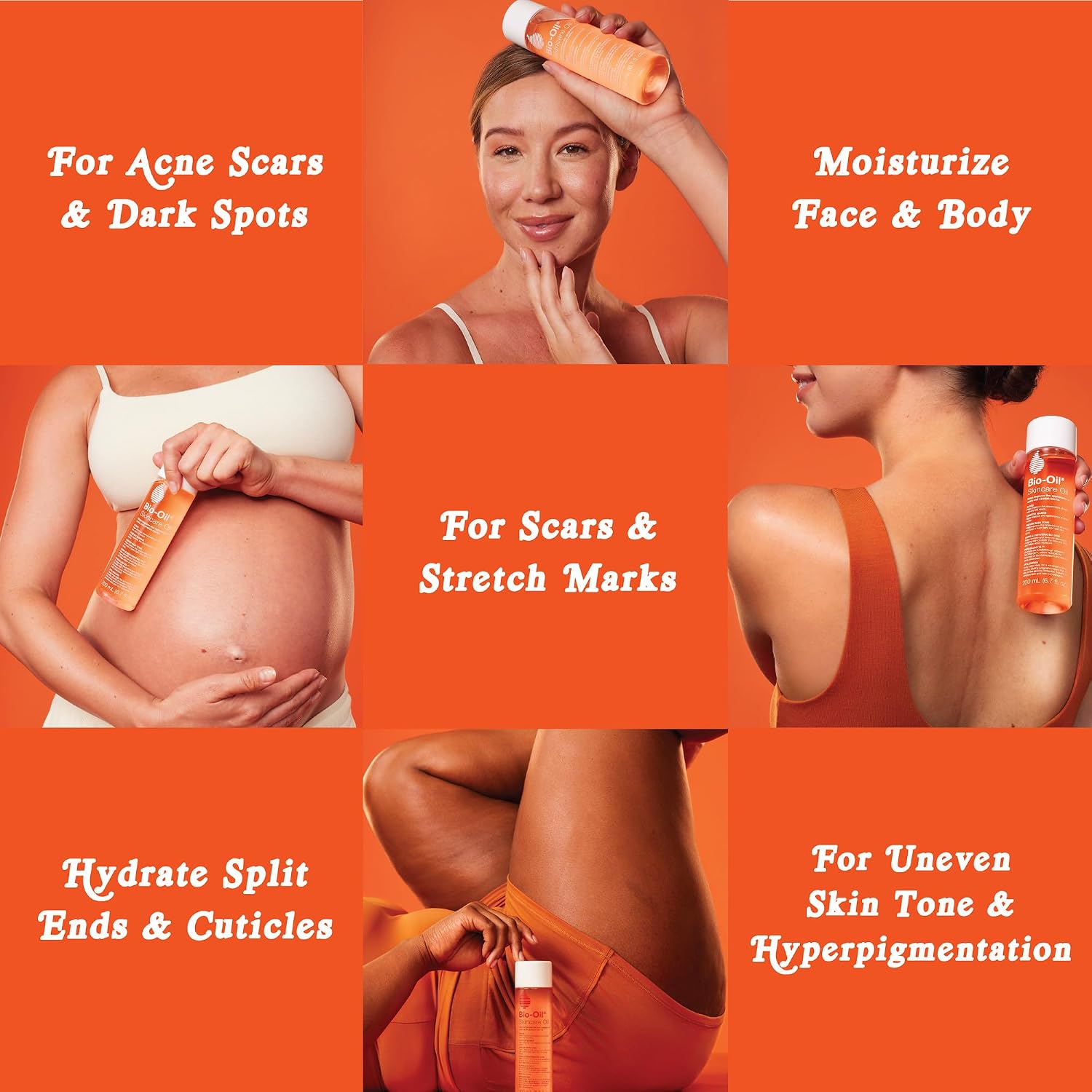 Bio-Oil Skincare Body Oil Serum, Scars & Stretch Marks, 2 fl oz | Dermatologist Recommended, Vitamin E & A, Dry & Sensitive Skin, Non-Comedogenic, Face and Body, Scar Treatment