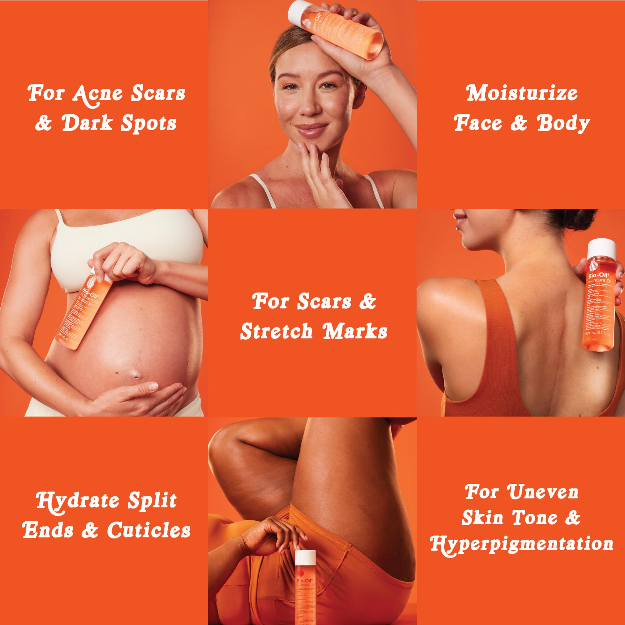 Bio-Oil Skincare Body Oil Serum, Scars & Stretch Marks, 2 fl oz | Dermatologist Recommended, Vitamin E & A, Dry & Sensitive Skin, Non-Comedogenic, Face and Body, Scar Treatment