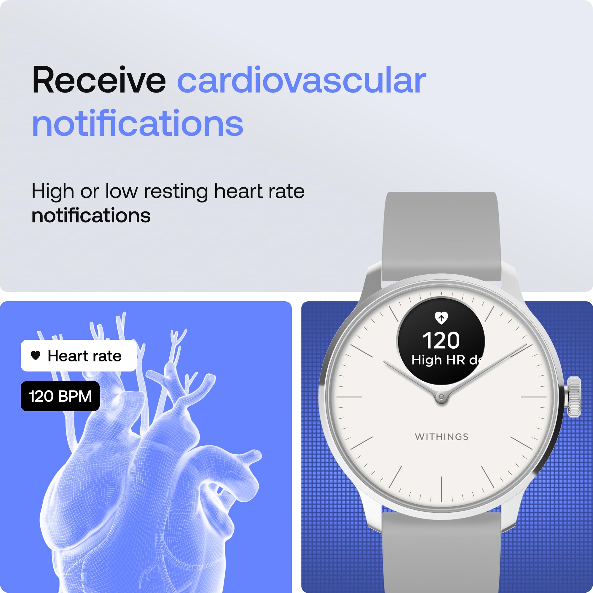 Withings ScanWatch Light - Hybrid Smart Watch, Heart Rate Monitoring, Fitness Tracker, Cycle Tracker, Sleep Monitoring