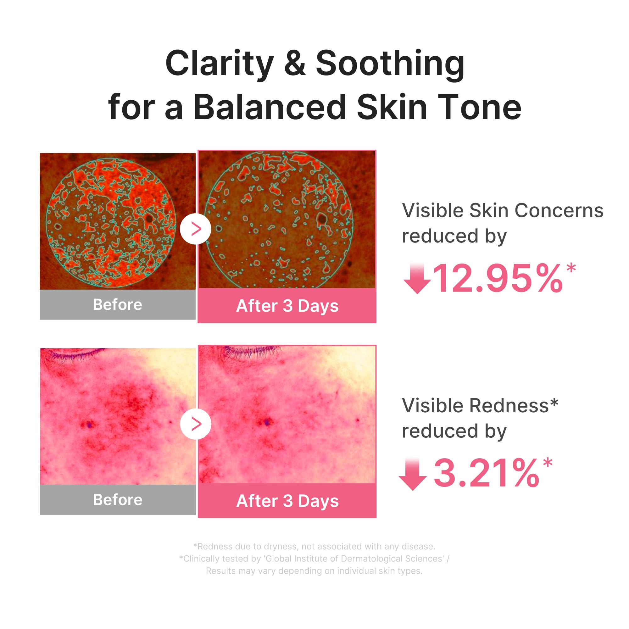 medicube PDRN Pink Peptide Serum with Salmon DNA | Pink Glow Serum with Peptides & Niacinamide for Hydration & Firm-Looking Skin | Uneven Tone Care | Korean Skincare, 1.01 fl. Oz