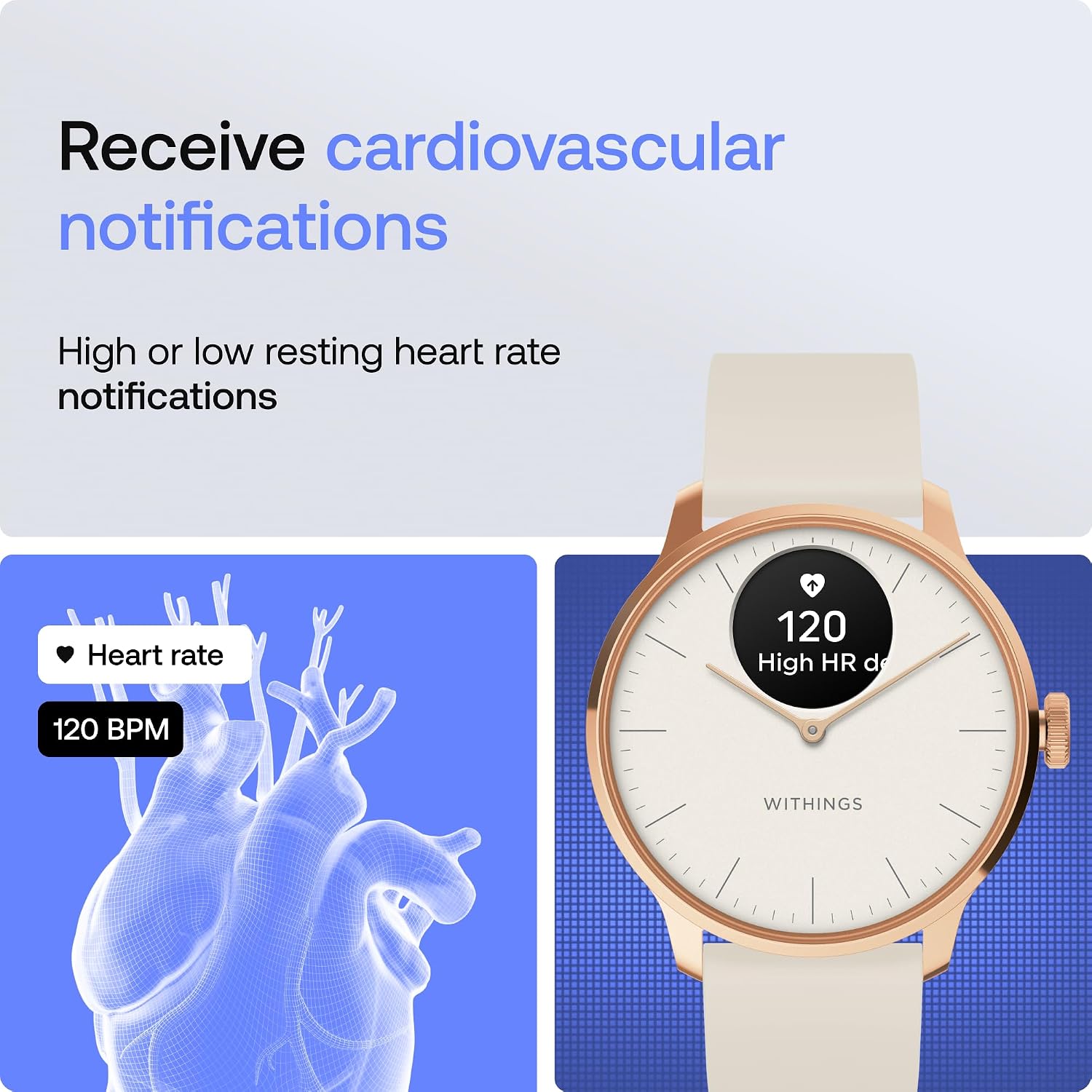 Withings ScanWatch Light - Hybrid Smart Watch, Heart Rate Monitoring, Fitness Tracker, Cycle Tracker, Sleep Monitoring