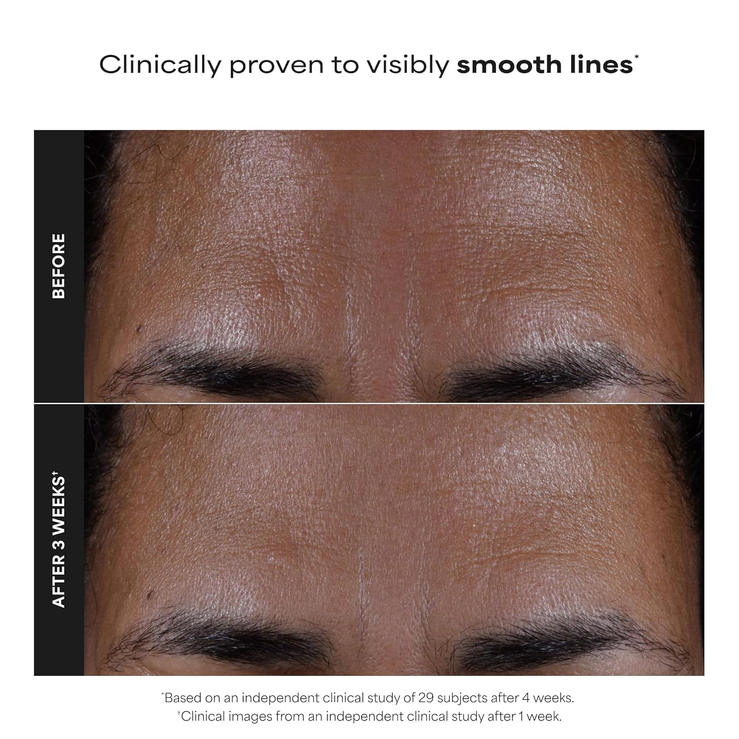 Paula's Choice SKIN PERFECTING 2% BHA Liquid Exfoliant | Gentle Salicylic Acid Facial Exfoliator for Blackheads, Enlarged Pores, Wrinkles & Fine Lines